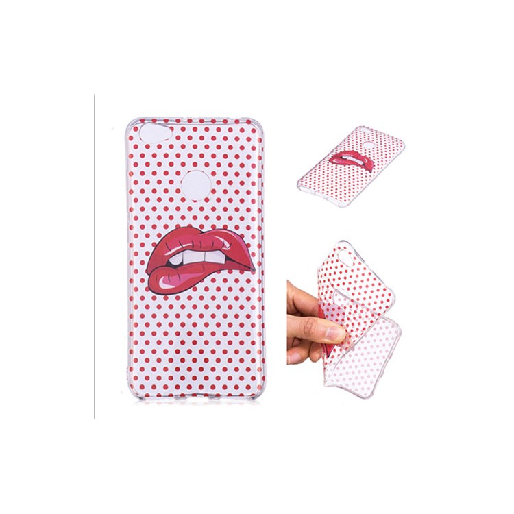 Pattern Printing IMD TPU Gel Case for Xiaomi Redmi Note 5A Prime / Y1 (India) - Red Lips-1