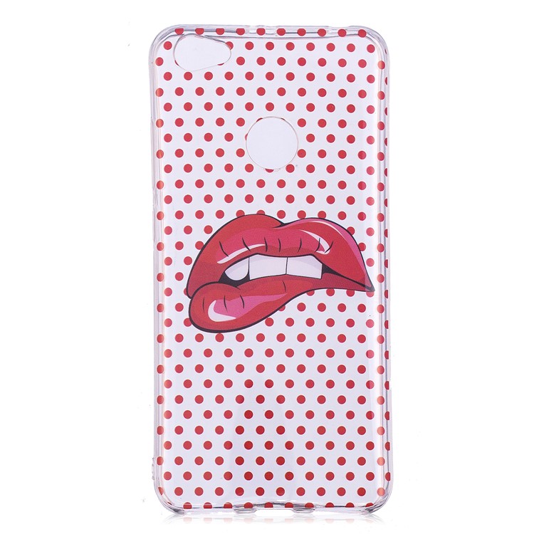 Pattern Printing IMD TPU Gel Case for Xiaomi Redmi Note 5A Prime / Y1 (India) - Red Lips-2