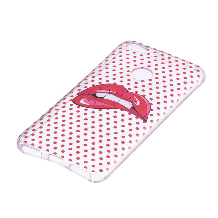 Pattern Printing IMD TPU Gel Case for Xiaomi Redmi Note 5A Prime / Y1 (India) - Red Lips-3