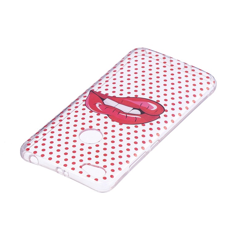 Pattern Printing IMD TPU Gel Case for Xiaomi Redmi Note 5A Prime / Y1 (India) - Red Lips-4
