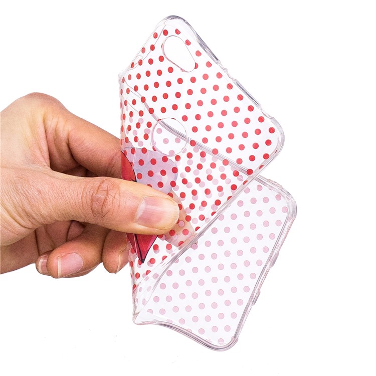 Pattern Printing IMD TPU Gel Case for Xiaomi Redmi Note 5A Prime / Y1 (India) - Red Lips-5
