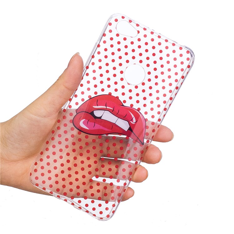 Pattern Printing IMD TPU Gel Case for Xiaomi Redmi Note 5A Prime / Y1 (India) - Red Lips-6