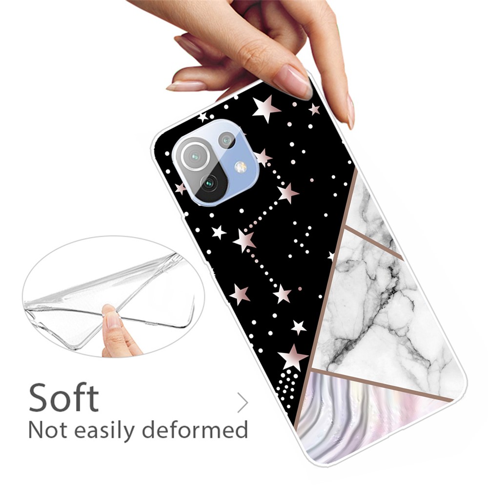 Soft TPU Marble Pattern Phone Protection Back Cover Case for Xiaomi Mi 11 Lite 4G/5G - Style A-3