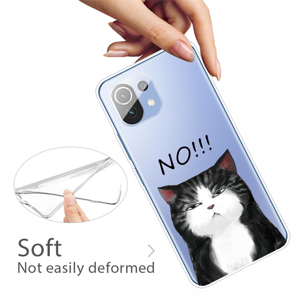 Shock-proof Stylish Pattern Printing TPU Phone Case for Xiaomi Mi 11 Lite 4G/5G - Angry Cat-3