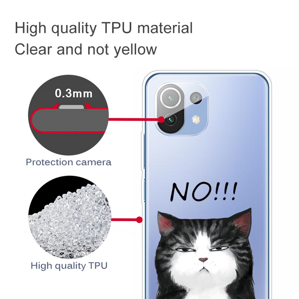 Shock-proof Stylish Pattern Printing TPU Phone Case for Xiaomi Mi 11 Lite 4G/5G - Angry Cat-4
