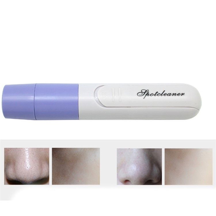 Facial Pore Cleaner Blackhead Acne Remover Face Blackhead Cleanser Electric Health Care Tool-1