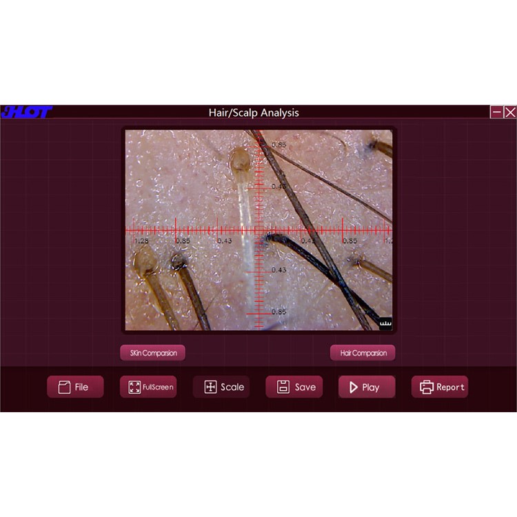 HOT-B30S 5X-200X 8 LED 2.0MP USB Digital Kopfhaut Haar Mikroskop Mit OTG Funktion Haut Detektor-19