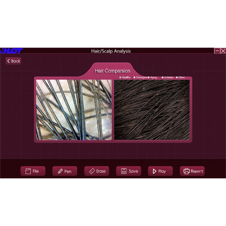 HOT-B30S 5X-200X 8 LED 2.0MP USB Digital Kopfhaut Haar Mikroskop Mit OTG Funktion Haut Detektor-22