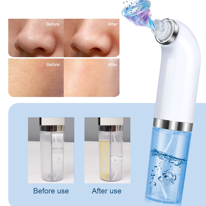 Visage Électrique Outils De Nettoyage Facial Facial Lave-linge Nettoyage Pinceau Vacuum Pore Remover